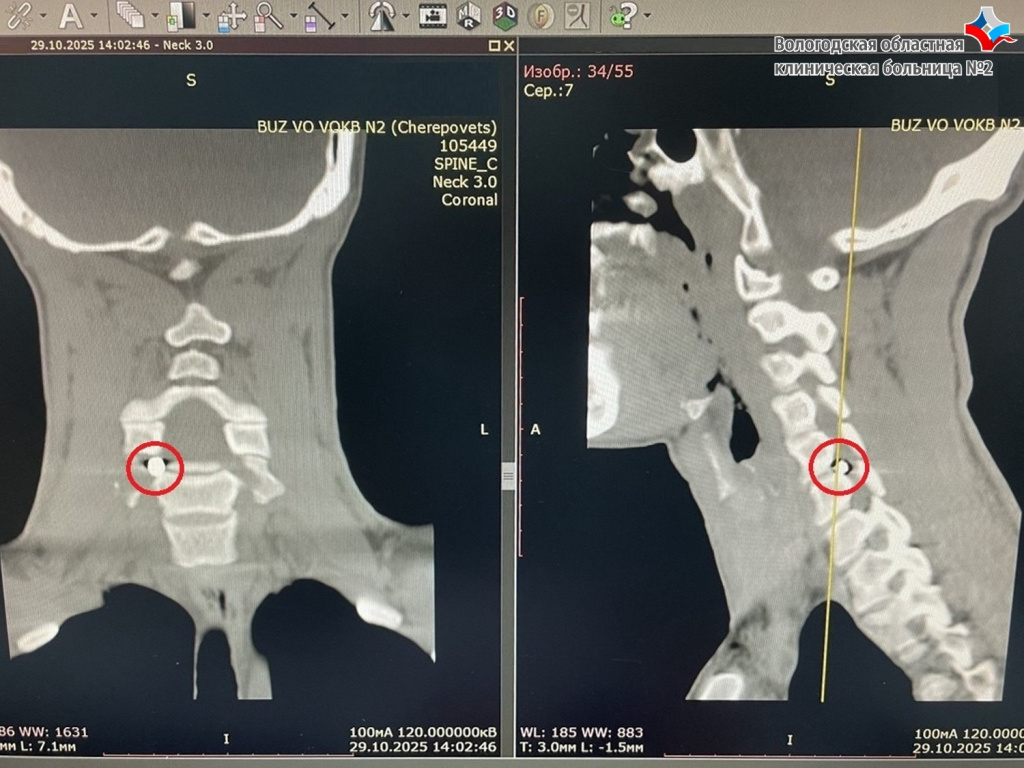 осколок.jpg осколок.jpg